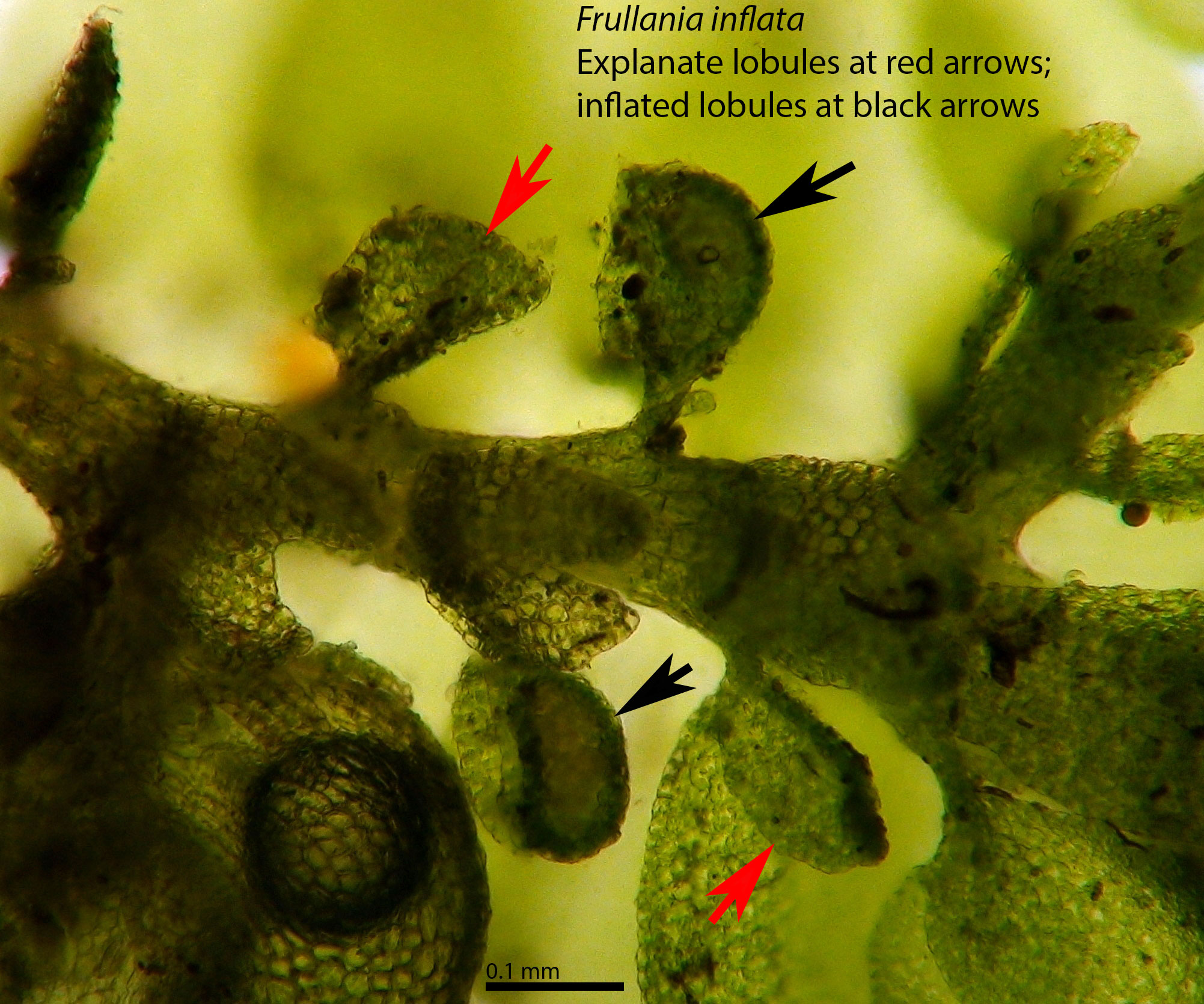 Lobule